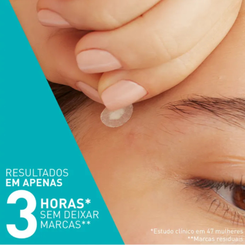 CeraVe Adesivos Anti-Borbulhas X22 – Redução de imperfeições
